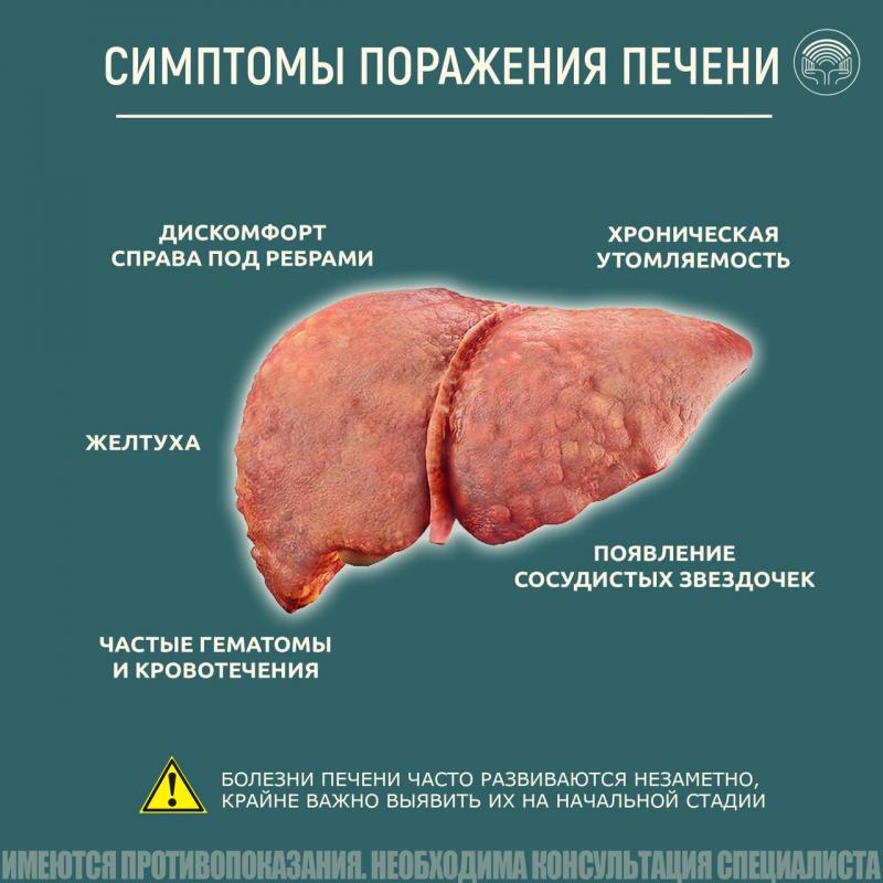 Симптомы поражения печени
