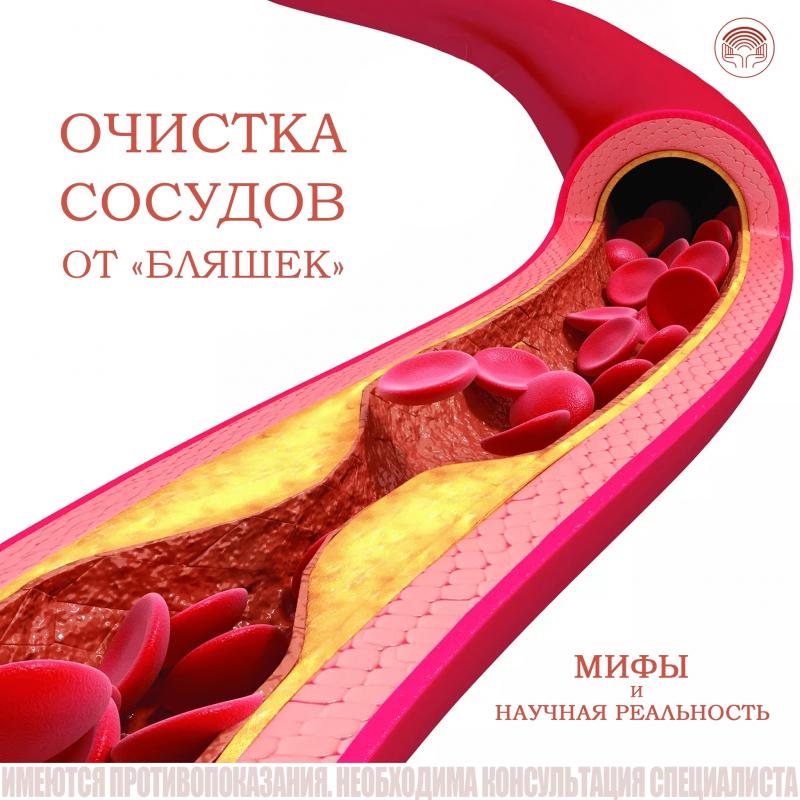 «Очистка сосудов» от бляшек: мифы и научная реальность