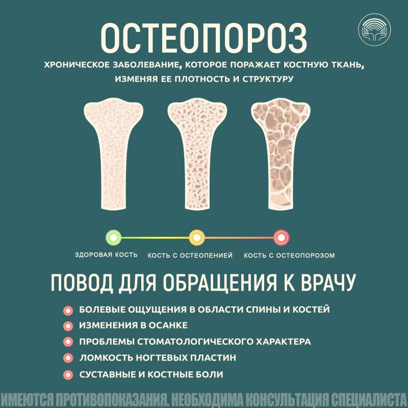 Остеопороз
