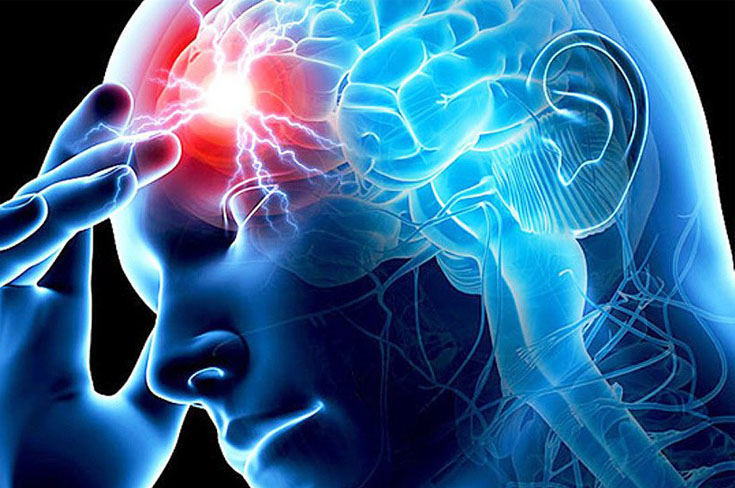 Как оценить риск инсульта Как оценить риск инсульта